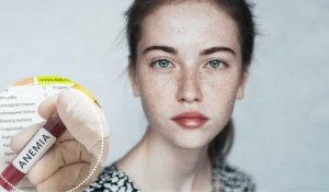 Anemia afectează sănătatea emoțională