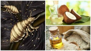 Elimini păduchii cu 5 remedii naturale