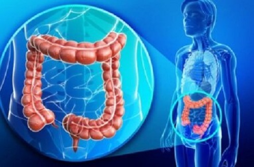 Simptome ale problemelor la colon precum sindromul de intestin iritabil