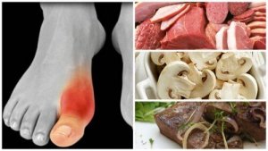 7 alimente interzise în regimul pentru gută