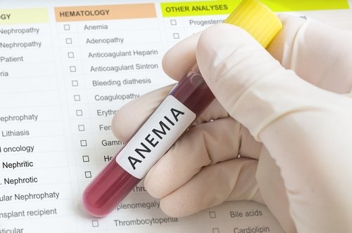 Beneficii ale pătrunjelului pentru anemie