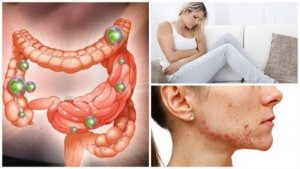 Dezechilibrele florei intestinale și cum te afectează