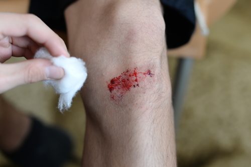 Hiperglicemia și diabetul provoacă o vindecare mai lentă a rănilor