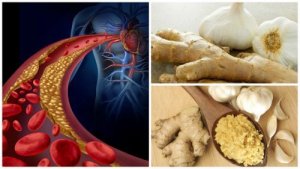 Hipertensiunea și colesterolul mărit: remediu natural