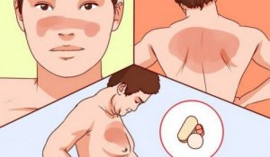 Informații despre boala Lupus: tot ce trebuie să știi