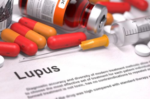 Informații despre boala Lupus și tratamentul necesar