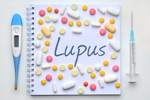 Lupusul poate fi greu de diagnosticat