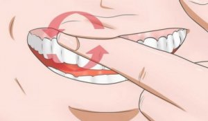 8 remedii naturale pentru gingiile inflamate