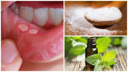 7 tratamente naturiste pentru aftele bucale