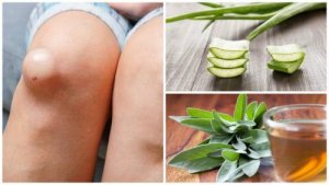 9 ponturi pentru ameliorarea durerilor de genunchi