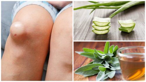 Umflăturile la genunchi: 5 remedii naturale - Doza de Sănătate