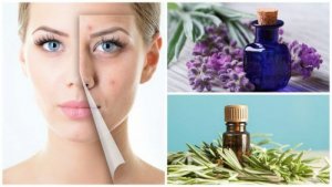 6 uleiuri esențiale care tratează acneea