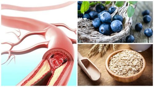 9 alimente care susțin sănătatea arterială 9 alimente care susțin sănătatea arterială