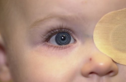 Și bebelușii pot avea cataractă