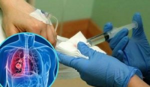 Medicament pentru efectele adverse ale chimioterapiei