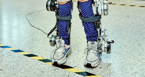 Acest exoschelet pentru copiii paraplegici este foarte costisitor