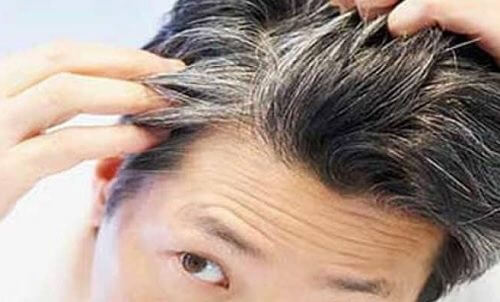 Poți preveni albirea părului cu 6 vitamine și alimente