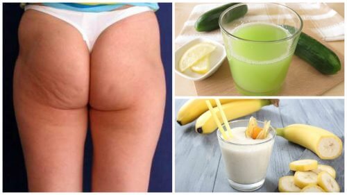 Reducerea aspectului celulitei cu 6 remedii naturiste Reducerea aspectului celulitei cu 6 remedii naturiste