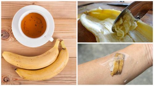 5 utilizări ale cojilor de banană în scop medicinal 5 utilizări ale cojilor de banană în scop medicinal