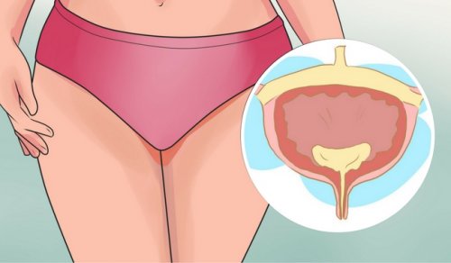 5 alimente care irită vezica urinară