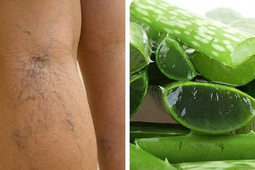 Aloe vera ajută la stimularea circulației la nivelul picioarelor