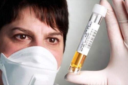 Analize pentru supraîncărcarea cu toxine a ficatului