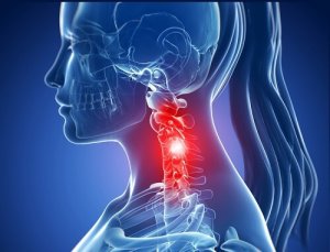 6 exerciții pentru întărirea mușchilor cervicali