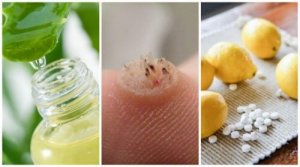 6 remedii puternice împotriva negilor