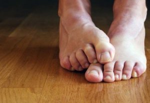 Micoza la unghiile picioarelor | Ghid medical, tratamente si remedii naturiste