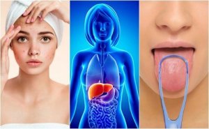 7 semne că ficatul este plin de toxine