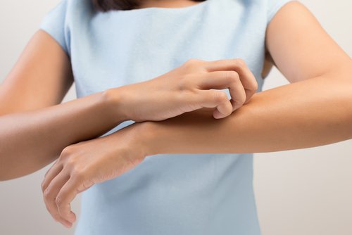 Supraîncărcarea cu toxine a ficatului afectând pielea