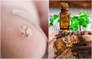 7 uleiuri esențiale care ajută la îndepărtarea negilor