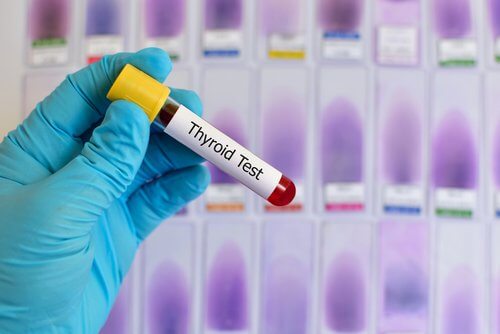 Analizele medicale pentru diferitele tipuri de hipotiroidism
