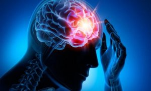 Top 4 cele mai frecvente boli cerebrovasculare