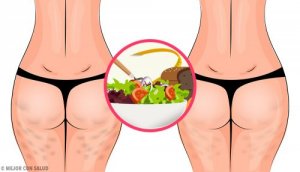 Cum să scapi de celulită cu o alimentație sănătoasă