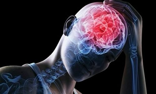 Embolia aflată printre cele mai frecvente boli cerebrovasculare