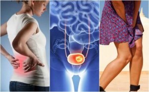 Cancerul de vezică urinară: 7 simptome