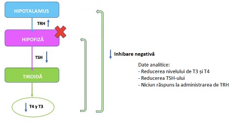 Tipuri de hipotiroidism și trăsăturile specifice