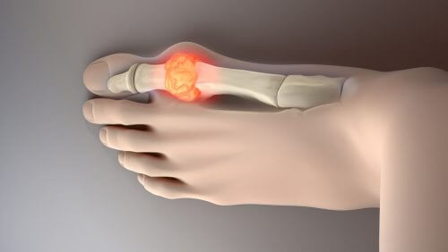 8 alimente care scad nivelul de acid uric din organism