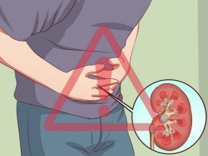 tratament pentru urinare grea remedii pietre la rinichi