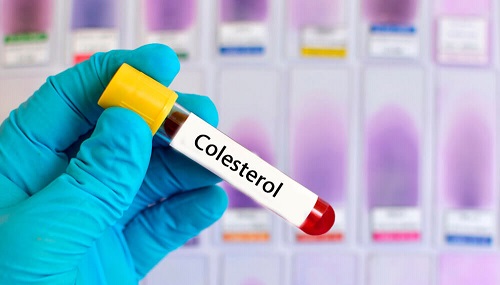 Beneficii ale consumului zilnic de miere pentru reglarea colesterolului
