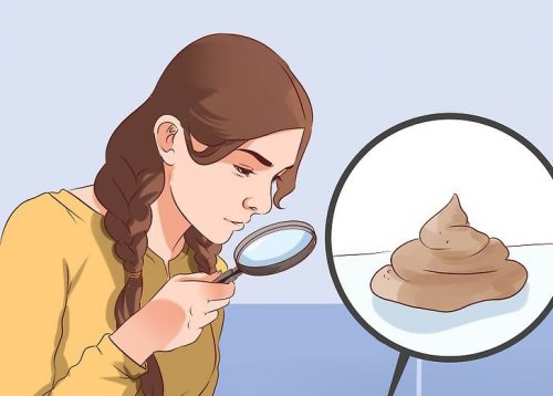 Ce indicii oferă culoarea scaunului despre sănătatea ta