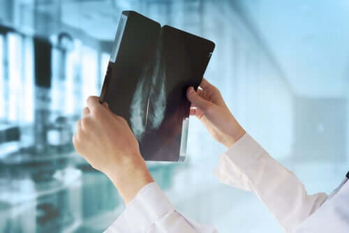 Medic verificând radiografia unui sân