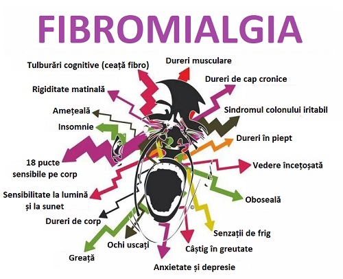 Moduri de a trata fibromialgia și simptomele bolii