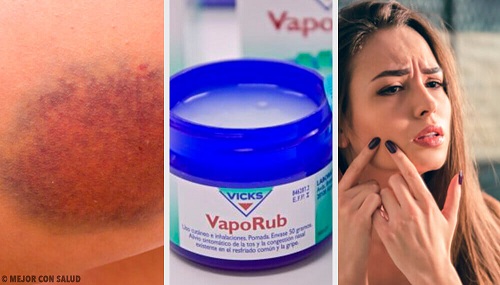 11 moduri de a utiliza Wick VapoRub 11 moduri de a utiliza Wick VapoRub