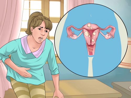 Remedii naturale pentru probleme menstruale comune Remedii naturale pentru probleme menstruale comune