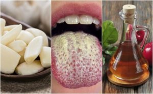 6 remedii naturiste împotriva Candidei