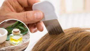 6 remedii naturiste pentru păduchi
