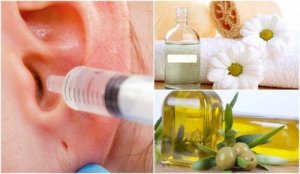 6 remedii pentru a elimina cerumenul