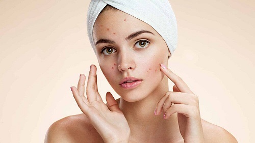 Acneea eliminată cu trucuri cosmetice cu oțet de mere